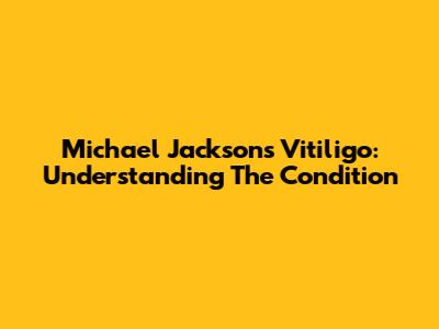 Michael Jackson's Vitiligo: Understanding The Condition